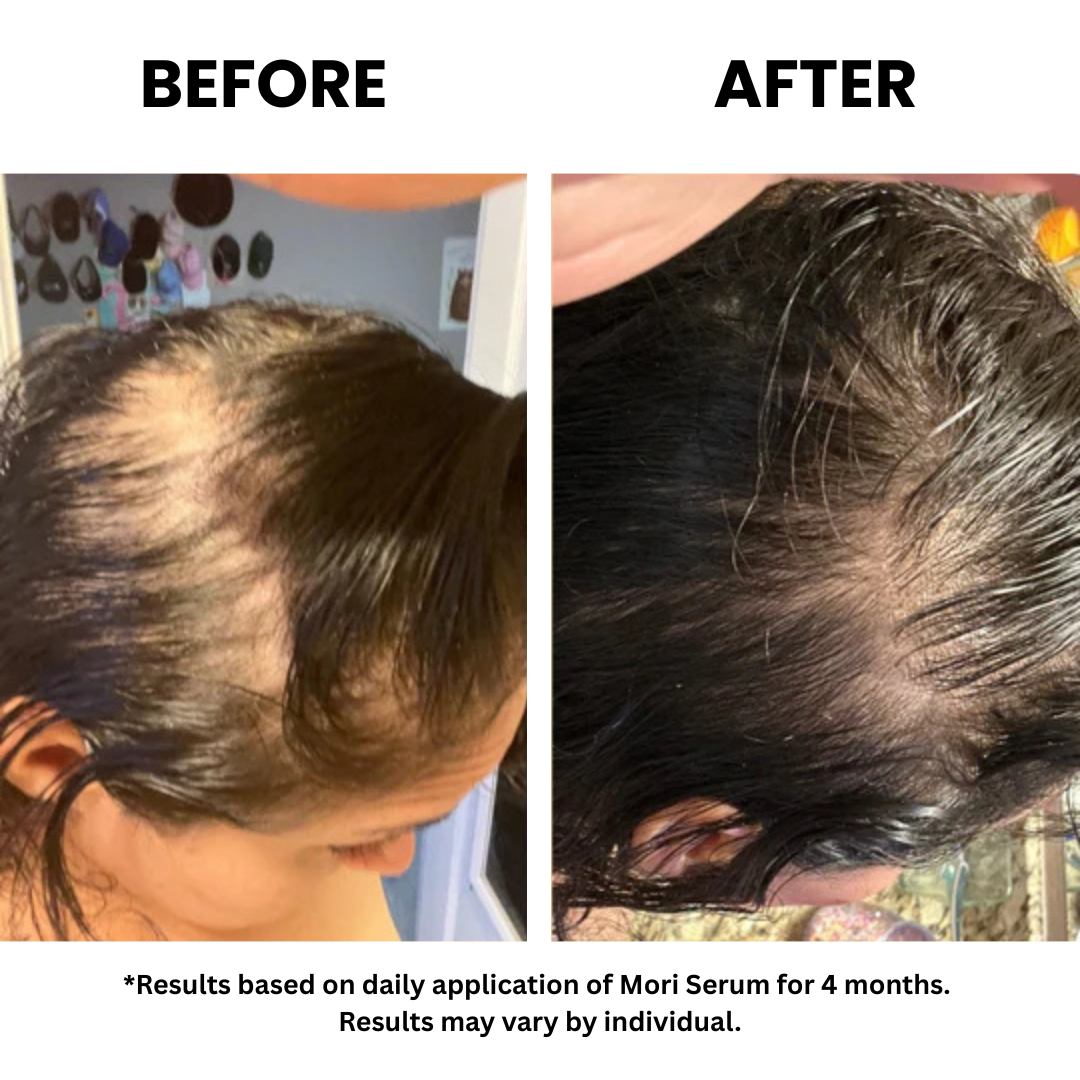 Advanced Copper Peptide Hair Regrowth Formula